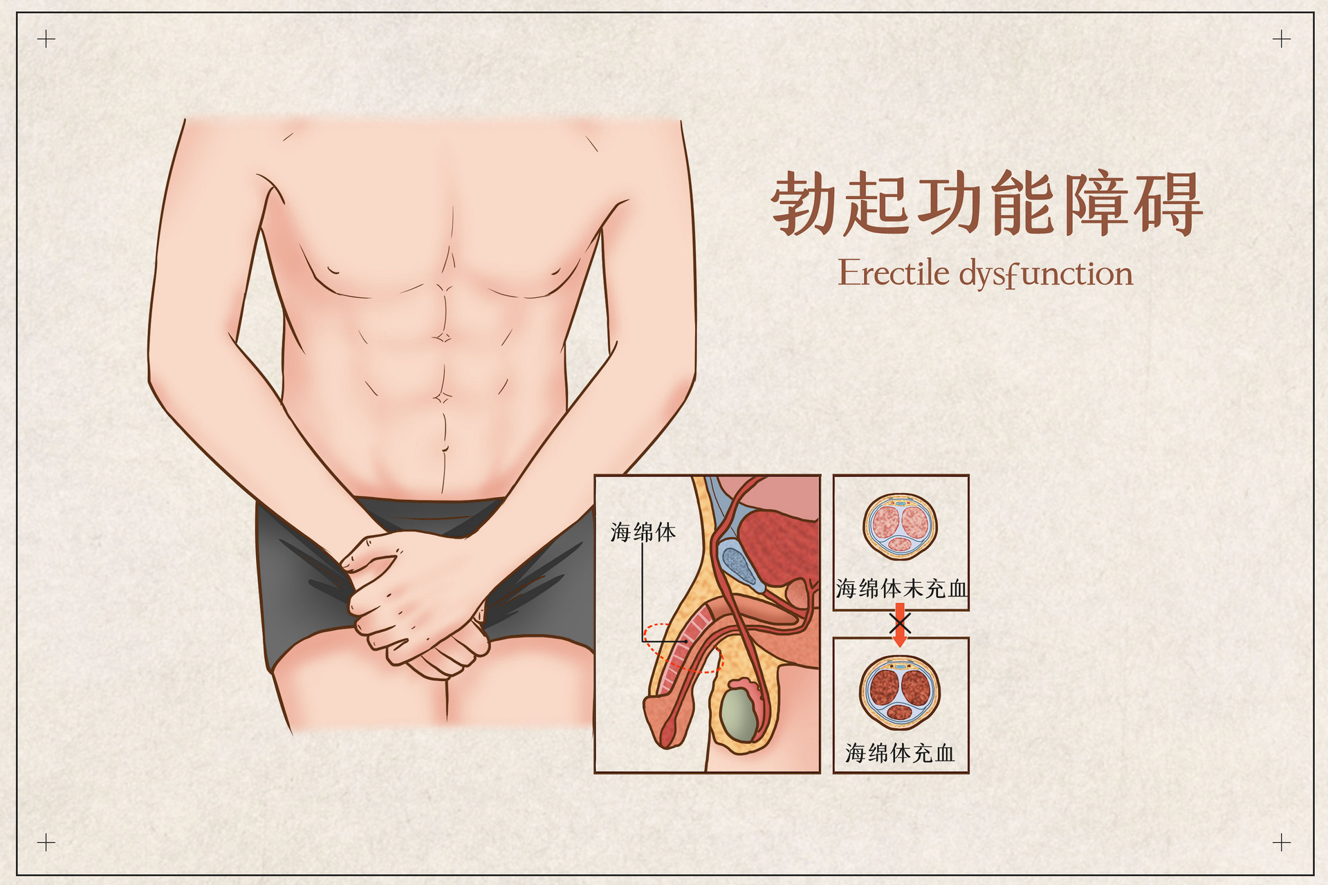 男性勃起功能障碍主要有什么影响