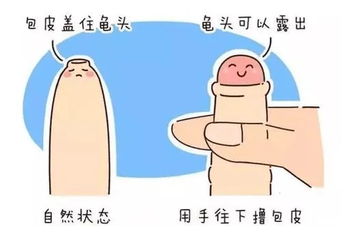 包皮包茎有什么坏处?